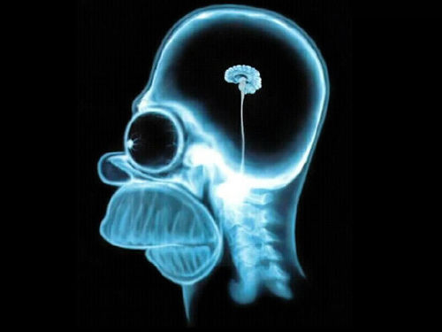 Homer-Brain-X-Ray-the-simpsons-60337_500_375.jpg