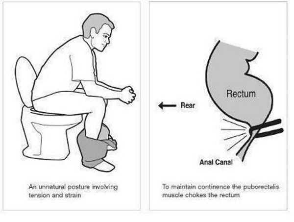 You've Been Sitting On The Toilet Wrong Your Whole Life. This Is How To Do It Right..jpg